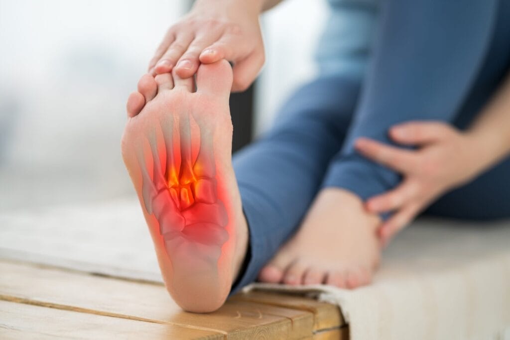 Plantar Fasciitis - Dealing with Heel Pain from Running